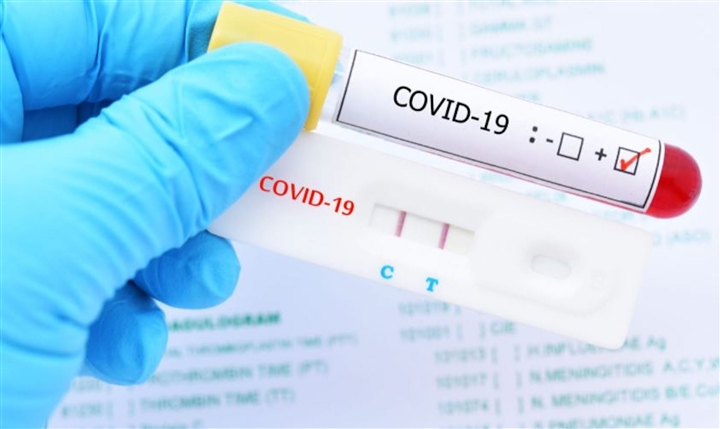 TP. Hồ Chí Minh: Bộ Y tế khuyến khích người dân tự test nhanh Covid-19 tại nhà